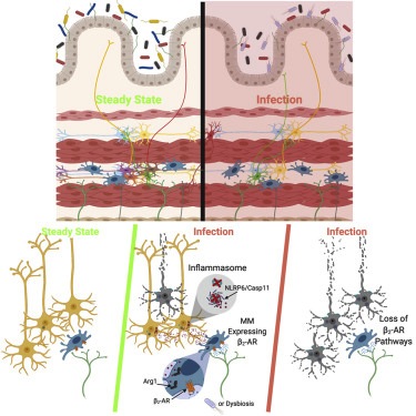 Illustration of gut inflammation