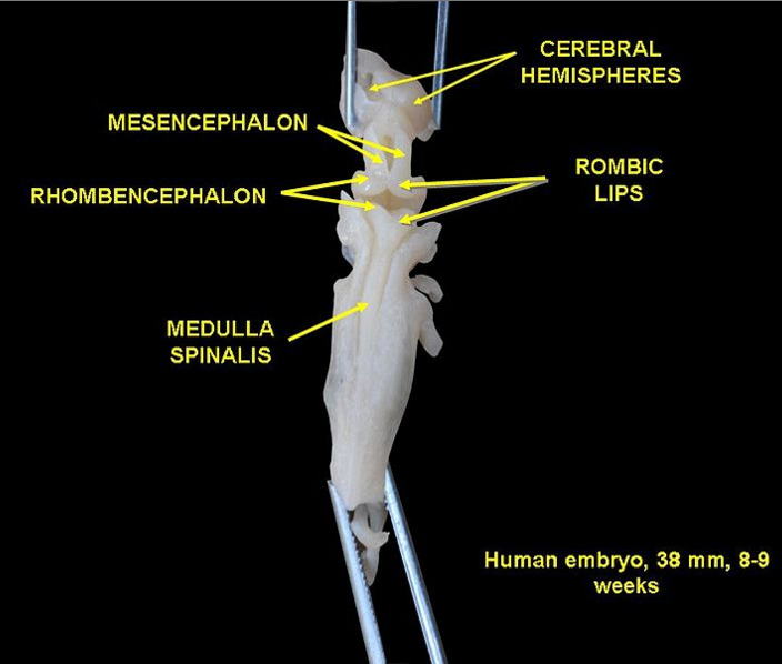 human rhombic lip